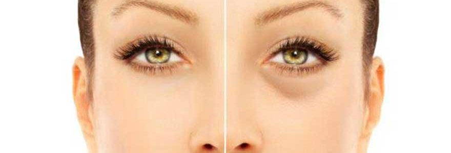 Los 10 antiojeras más efectivos y baratos del mercado